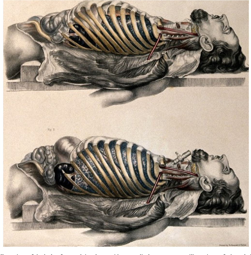 Medical Anatomy - Francis Sibson (1869) - 3-Figure3-1